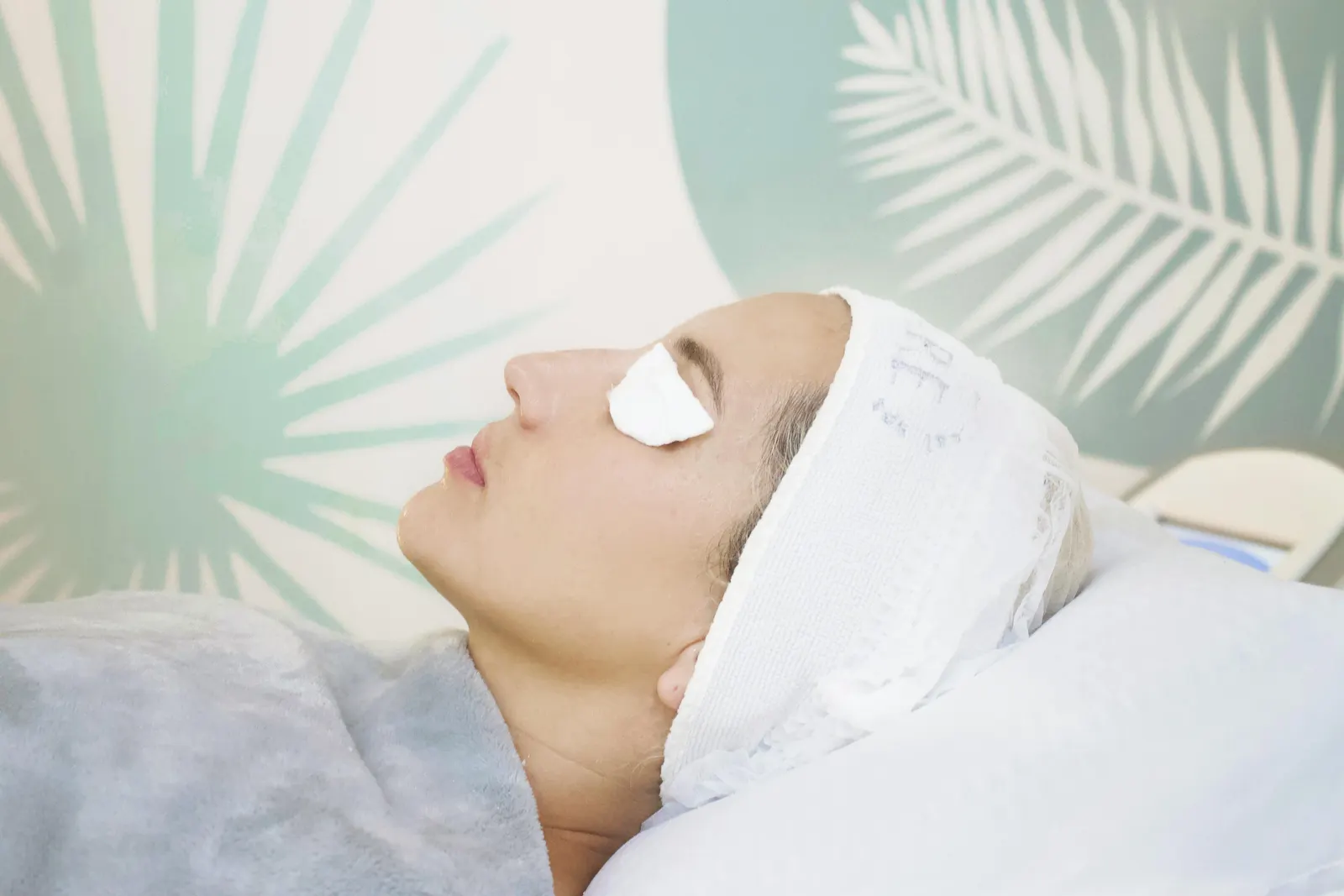 Skin Cell Regeneration: The Role of TCA Peels