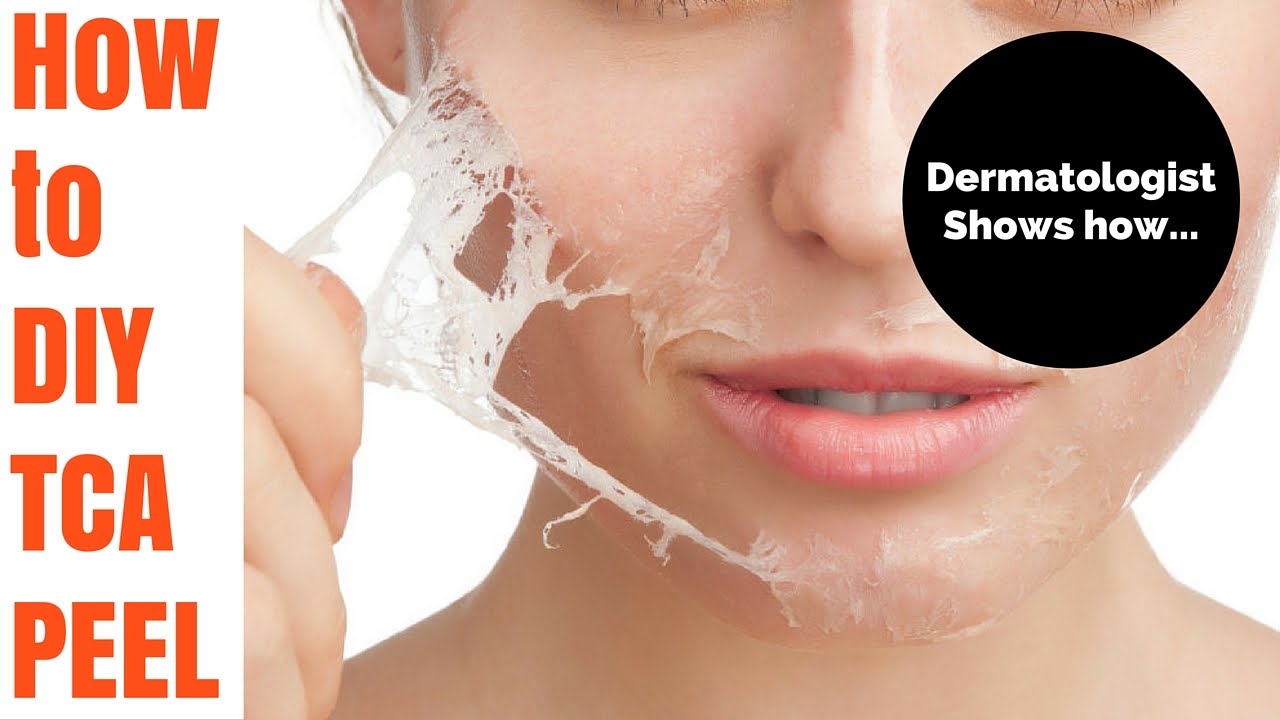 100% TCA Peel | Pure Professional Strength – RePare Skincare